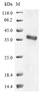 (Tris-Glycine gel) Discontinuous SDS-PAGE (reduced) with 5% enrichment gel and 15% separation gel. (Tris-Glycine gel) Discontinuous SDS-PAGE (reduced) with 5% enrichment gel and 15% separation gel.