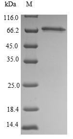 (Tris-Glycine gel) Discontinuous SDS-PAGE (reduced) with 5% enrichment gel and 15% separation gel. (Tris-Glycine gel) Discontinuous SDS-PAGE (reduced) with 5% enrichment gel and 15% separation gel.