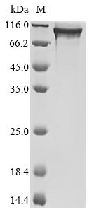 (Tris-Glycine gel) Discontinuous SDS-PAGE (reduced) with 5% enrichment gel and 15% separation gel. (Tris-Glycine gel) Discontinuous SDS-PAGE (reduced) with 5% enrichment gel and 15% separation gel.