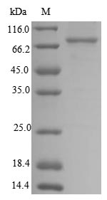 SDS-PAGE- Recombinant protein Human NRROS