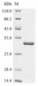 (Tris-Glycine gel) Discontinuous SDS-PAGE (reduced) with 5% enrichment gel and 15% separation gel.