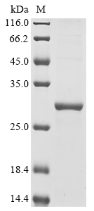 (Tris-Glycine gel) Discontinuous SDS-PAGE (reduced) with 5% enrichment gel and 15% separation gel.