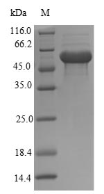 (Tris-Glycine gel) Discontinuous SDS-PAGE (reduced) with 5% enrichment gel and 15% separation gel. (Tris-Glycine gel) Discontinuous SDS-PAGE (reduced) with 5% enrichment gel and 15% separation gel.