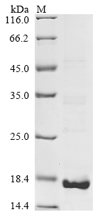 (Tris-Glycine gel) Discontinuous SDS-PAGE (reduced) with 5% enrichment gel and 15% separation gel. (Tris-Glycine gel) Discontinuous SDS-PAGE (reduced) with 5% enrichment gel and 15% separation gel.