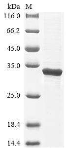 (Tris-Glycine gel) Discontinuous SDS-PAGE (reduced) with 5% enrichment gel and 15% separation gel. (Tris-Glycine gel) Discontinuous SDS-PAGE (reduced) with 5% enrichment gel and 15% separation gel.