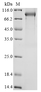 (Tris-Glycine gel) Discontinuous SDS-PAGE (reduced) with 5% enrichment gel and 15% separation gel. (Tris-Glycine gel) Discontinuous SDS-PAGE (reduced) with 5% enrichment gel and 15% separation gel.