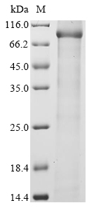 (Tris-Glycine gel) Discontinuous SDS-PAGE (reduced) with 5% enrichment gel and 15% separation gel. (Tris-Glycine gel) Discontinuous SDS-PAGE (reduced) with 5% enrichment gel and 15% separation gel.