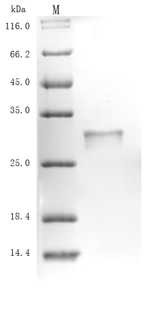 (Tris-Glycine gel) Discontinuous SDS-PAGE (reduced) with 5% enrichment gel and 15% separation gel.