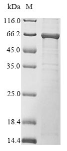 (Tris-Glycine gel) Discontinuous SDS-PAGE (reduced) with 5% enrichment gel and 15% separation gel. (Tris-Glycine gel) Discontinuous SDS-PAGE (reduced) with 5% enrichment gel and 15% separation gel.