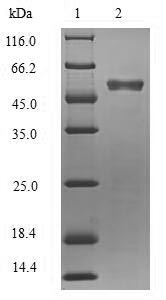 (Tris-Glycine gel) Discontinuous SDS-PAGE (reduced) with 5% enrichment gel and 15% separation gel. (Tris-Glycine gel) Discontinuous SDS-PAGE (reduced) with 5% enrichment gel and 15% separation gel.