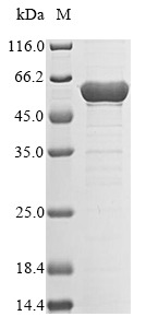 (Tris-Glycine gel) Discontinuous SDS-PAGE (reduced) with 5% enrichment gel and 15% separation gel. (Tris-Glycine gel) Discontinuous SDS-PAGE (reduced) with 5% enrichment gel and 15% separation gel.