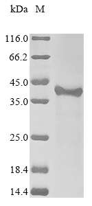 (Tris-Glycine gel) Discontinuous SDS-PAGE (reduced) with 5% enrichment gel and 15% separation gel. (Tris-Glycine gel) Discontinuous SDS-PAGE (reduced) with 5% enrichment gel and 15% separation gel.