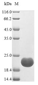 (Tris-Glycine gel) Discontinuous SDS-PAGE (reduced) with 5% enrichment gel and 15% separation gel. (Tris-Glycine gel) Discontinuous SDS-PAGE (reduced) with 5% enrichment gel and 15% separation gel.