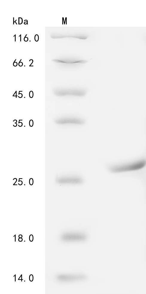 (Tris-Glycine gel) Discontinuous SDS-PAGE (reduced) with 5% enrichment gel and 15% separation gel. (Tris-Glycine gel) Discontinuous SDS-PAGE (reduced) with 5% enrichment gel and 15% separation gel.