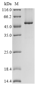 (Tris-Glycine gel) Discontinuous SDS-PAGE (reduced) with 5% enrichment gel and 15% separation gel. (Tris-Glycine gel) Discontinuous SDS-PAGE (reduced) with 5% enrichment gel and 15% separation gel.