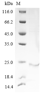 (Tris-Glycine gel) Discontinuous SDS-PAGE (reduced) with 5% enrichment gel and 15% separation gel. (Tris-Glycine gel) Discontinuous SDS-PAGE (reduced) with 5% enrichment gel and 15% separation gel.