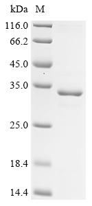 (Tris-Glycine gel) Discontinuous SDS-PAGE (reduced) with 5% enrichment gel and 15% separation gel. (Tris-Glycine gel) Discontinuous SDS-PAGE (reduced) with 5% enrichment gel and 15% separation gel.