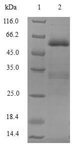 (Tris-Glycine gel) Discontinuous SDS-PAGE (reduced) with 5% enrichment gel and 15% separation gel. (Tris-Glycine gel) Discontinuous SDS-PAGE (reduced) with 5% enrichment gel and 15% separation gel.