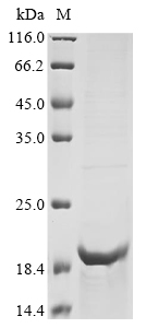 (Tris-Glycine gel) Discontinuous SDS-PAGE (reduced) with 5% enrichment gel and 15% separation gel. (Tris-Glycine gel) Discontinuous SDS-PAGE (reduced) with 5% enrichment gel and 15% separation gel.