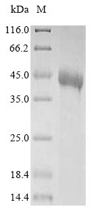 (Tris-Glycine gel) Discontinuous SDS-PAGE (reduced) with 5% enrichment gel and 15% separation gel. (Tris-Glycine gel) Discontinuous SDS-PAGE (reduced) with 5% enrichment gel and 15% separation gel.
