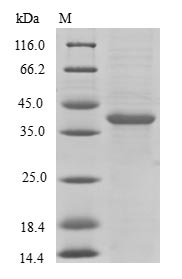 (Tris-Glycine gel) Discontinuous SDS-PAGE (reduced) with 5% enrichment gel and 15% separation gel. (Tris-Glycine gel) Discontinuous SDS-PAGE (reduced) with 5% enrichment gel and 15% separation gel.