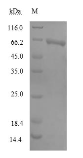(Tris-Glycine gel) Discontinuous SDS-PAGE (reduced) with 5% enrichment gel and 15% separation gel. (Tris-Glycine gel) Discontinuous SDS-PAGE (reduced) with 5% enrichment gel and 15% separation gel.