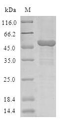 (Tris-Glycine gel) Discontinuous SDS-PAGE (reduced) with 5% enrichment gel and 15% separation gel. (Tris-Glycine gel) Discontinuous SDS-PAGE (reduced) with 5% enrichment gel and 15% separation gel.