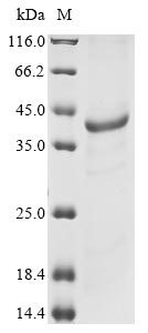 (Tris-Glycine gel) Discontinuous SDS-PAGE (reduced) with 5% enrichment gel and 15% separation gel. (Tris-Glycine gel) Discontinuous SDS-PAGE (reduced) with 5% enrichment gel and 15% separation gel.