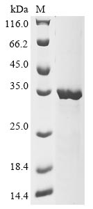 (Tris-Glycine gel) Discontinuous SDS-PAGE (reduced) with 5% enrichment gel and 15% separation gel. (Tris-Glycine gel) Discontinuous SDS-PAGE (reduced) with 5% enrichment gel and 15% separation gel.