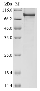 (Tris-Glycine gel) Discontinuous SDS-PAGE (reduced) with 5% enrichment gel and 15% separation gel. (Tris-Glycine gel) Discontinuous SDS-PAGE (reduced) with 5% enrichment gel and 15% separation gel.