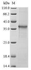 (Tris-Glycine gel) Discontinuous SDS-PAGE (reduced) with 5% enrichment gel and 15% separation gel. (Tris-Glycine gel) Discontinuous SDS-PAGE (reduced) with 5% enrichment gel and 15% separation gel.