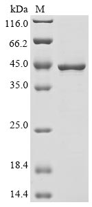(Tris-Glycine gel) Discontinuous SDS-PAGE (reduced) with 5% enrichment gel and 15% separation gel. (Tris-Glycine gel) Discontinuous SDS-PAGE (reduced) with 5% enrichment gel and 15% separation gel.
