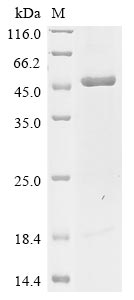(Tris-Glycine gel) Discontinuous SDS-PAGE (reduced) with 5% enrichment gel and 15% separation gel. (Tris-Glycine gel) Discontinuous SDS-PAGE (reduced) with 5% enrichment gel and 15% separation gel.