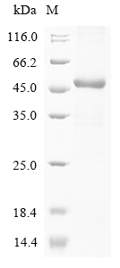 (Tris-Glycine gel) Discontinuous SDS-PAGE (reduced) with 5% enrichment gel and 15% separation gel. (Tris-Glycine gel) Discontinuous SDS-PAGE (reduced) with 5% enrichment gel and 15% separation gel.