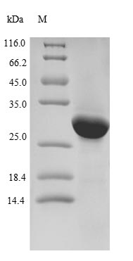 (Tris-Glycine gel) Discontinuous SDS-PAGE (reduced) with 5% enrichment gel and 15% separation gel. (Tris-Glycine gel) Discontinuous SDS-PAGE (reduced) with 5% enrichment gel and 15% separation gel.