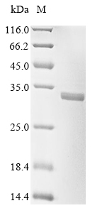 (Tris-Glycine gel) Discontinuous SDS-PAGE (reduced) with 5% enrichment gel and 15% separation gel. (Tris-Glycine gel) Discontinuous SDS-PAGE (reduced) with 5% enrichment gel and 15% separation gel.