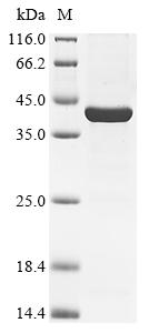 (Tris-Glycine gel) Discontinuous SDS-PAGE (reduced) with 5% enrichment gel and 15% separation gel. (Tris-Glycine gel) Discontinuous SDS-PAGE (reduced) with 5% enrichment gel and 15% separation gel.