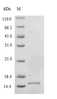 (Tris-Glycine gel) Discontinuous SDS-PAGE (reduced) with 5% enrichment gel and 15% separation gel. (Tris-Glycine gel) Discontinuous SDS-PAGE (reduced) with 5% enrichment gel and 15% separation gel.