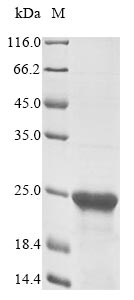 (Tris-Glycine gel) Discontinuous SDS-PAGE (reduced) with 5% enrichment gel and 15% separation gel. (Tris-Glycine gel) Discontinuous SDS-PAGE (reduced) with 5% enrichment gel and 15% separation gel.