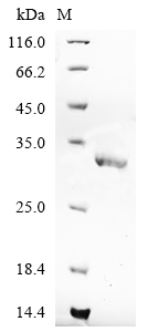 (Tris-Glycine gel) Discontinuous SDS-PAGE (reduced) with 5% enrichment gel and 15% separation gel.