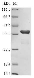 Mosaic CREBBP mutation causes overlapping clinical features of Rubinstein– Taybi and Filippi syndromes