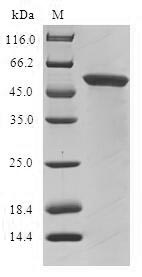 (Tris-Glycine gel) Discontinuous SDS-PAGE (reduced) with 5% enrichment gel and 15% separation gel. (Tris-Glycine gel) Discontinuous SDS-PAGE (reduced) with 5% enrichment gel and 15% separation gel.