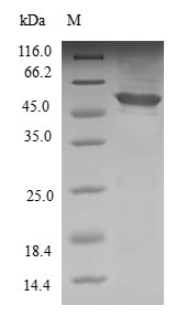 (Tris-Glycine gel) Discontinuous SDS-PAGE (reduced) with 5% enrichment gel and 15% separation gel. (Tris-Glycine gel) Discontinuous SDS-PAGE (reduced) with 5% enrichment gel and 15% separation gel.