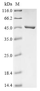 (Tris-Glycine gel) Discontinuous SDS-PAGE (reduced) with 5% enrichment gel and 15% separation gel. (Tris-Glycine gel) Discontinuous SDS-PAGE (reduced) with 5% enrichment gel and 15% separation gel.
