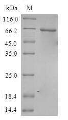 (Tris-Glycine gel) Discontinuous SDS-PAGE (reduced) with 5% enrichment gel and 15% separation gel. (Tris-Glycine gel) Discontinuous SDS-PAGE (reduced) with 5% enrichment gel and 15% separation gel.