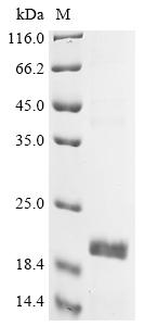 (Tris-Glycine gel) Discontinuous SDS-PAGE (reduced) with 5% enrichment gel and 15% separation gel. (Tris-Glycine gel) Discontinuous SDS-PAGE (reduced) with 5% enrichment gel and 15% separation gel.