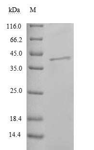 (Tris-Glycine gel) Discontinuous SDS-PAGE (reduced) with 5% enrichment gel and 15% separation gel.