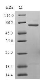 (Tris-Glycine gel) Discontinuous SDS-PAGE (reduced) with 5% enrichment gel and 15% separation gel. (Tris-Glycine gel) Discontinuous SDS-PAGE (reduced) with 5% enrichment gel and 15% separation gel.