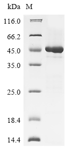 (Tris-Glycine gel) Discontinuous SDS-PAGE (reduced) with 5% enrichment gel and 15% separation gel.
