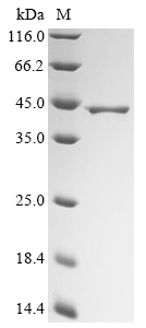 (Tris-Glycine gel) Discontinuous SDS-PAGE (reduced) with 5% enrichment gel and 15% separation gel.